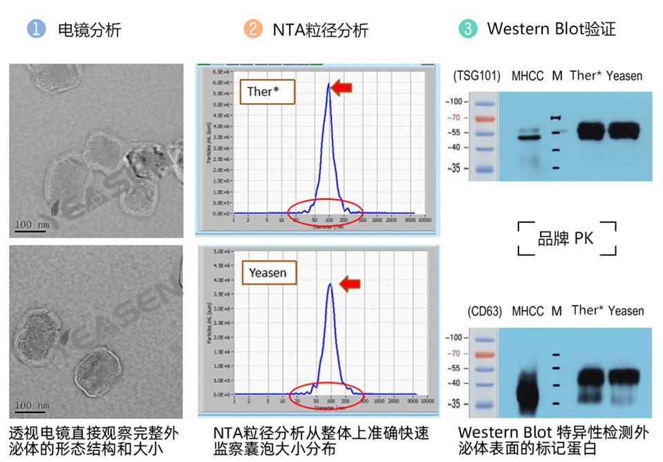 提取产物经过电镜分析，NTA粒径分析和WB实验三大外泌体金标准.jpg