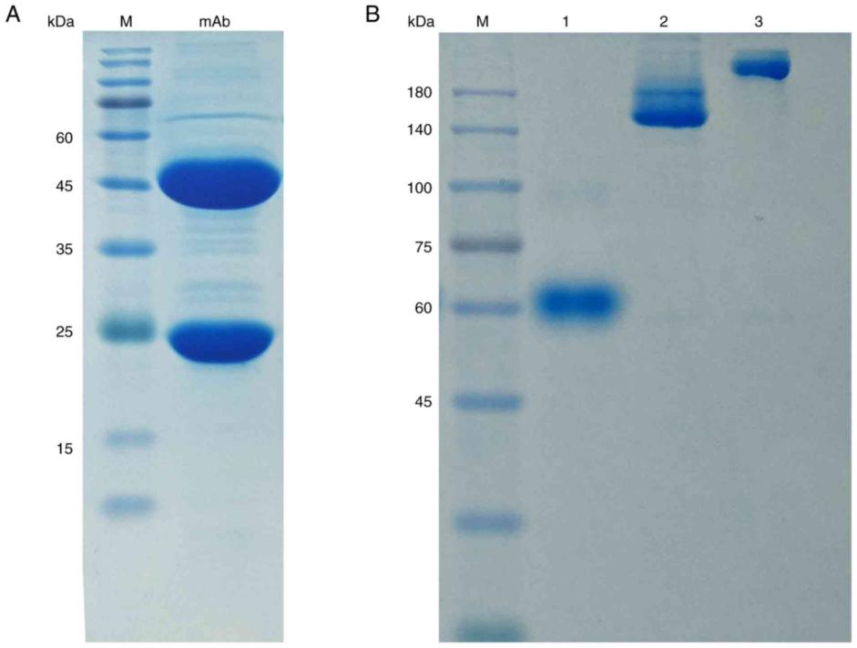 图2  A：12%SDS-PAGE    B：8%SDS-PAGE.jpg