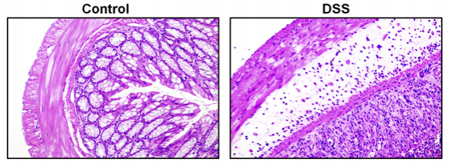DSS急性结肠炎切片HE染色结果