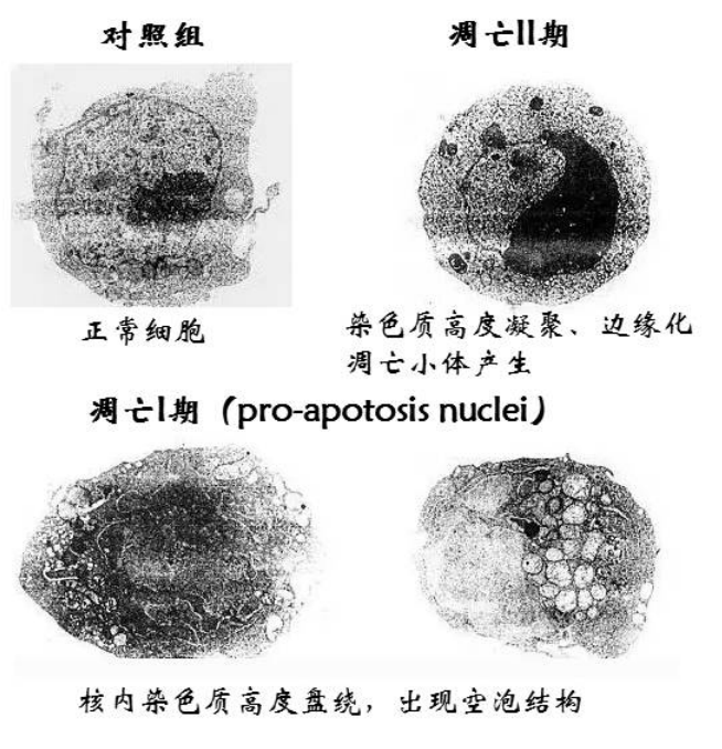 凋亡小体电镜图片